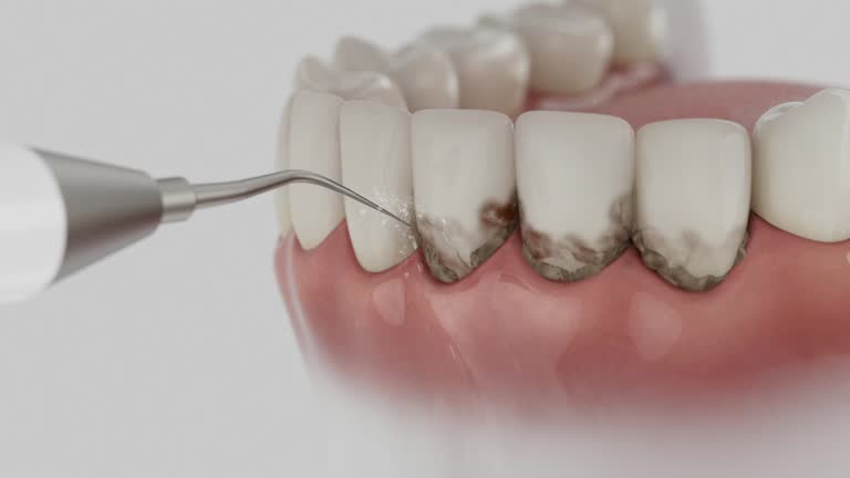 Reliable Dental contractor in Erma, NJ by Smile Center Dentistry